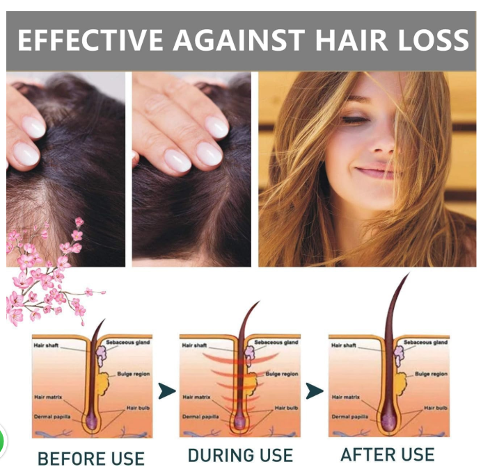 Sakura Japanese Shampoo For Hair Loss