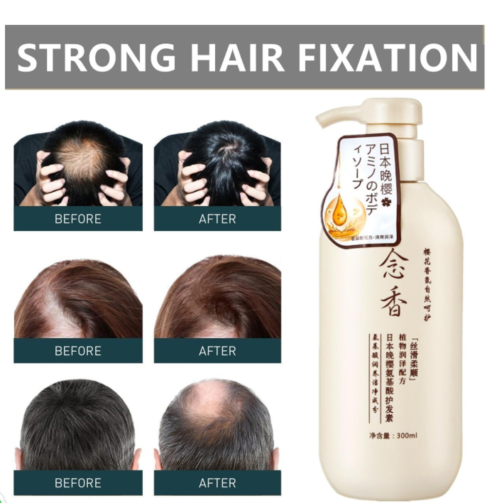 Sakura Japanese Shampoo For Hair Loss